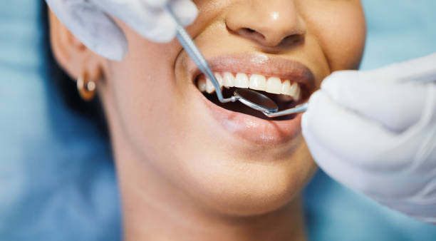 Best Emergency Dentist for Lost Fillings or Crowns in Wooster, AR